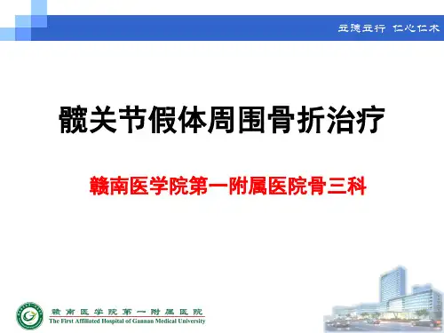髋关节假体周围骨折治疗