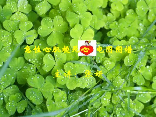 急性心肌梗死心电图汇总.
