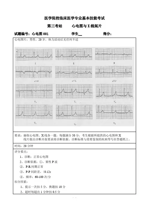 心电图技能考核练习题