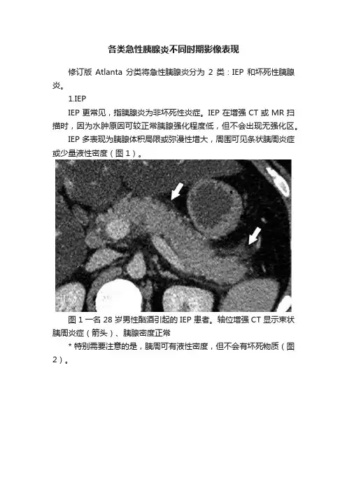 各类急性胰腺炎不同时期影像表现
