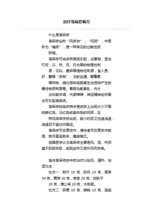治疗荨麻疹偏方