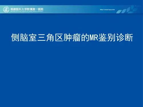 侧脑室三角区肿瘤PPT