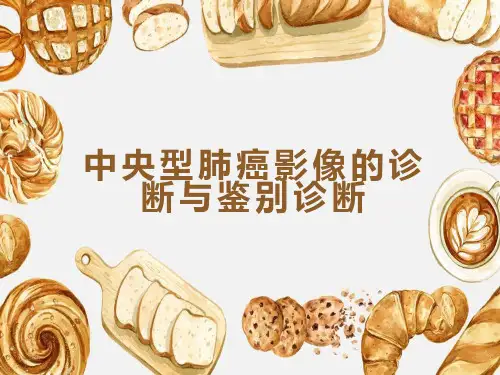 中央型肺癌的影像诊断与鉴别诊断