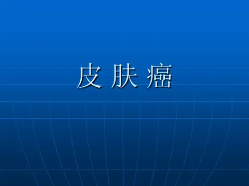 皮肤癌PPT课件