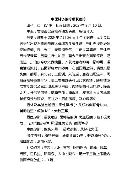 中医针灸治疗带状疱疹