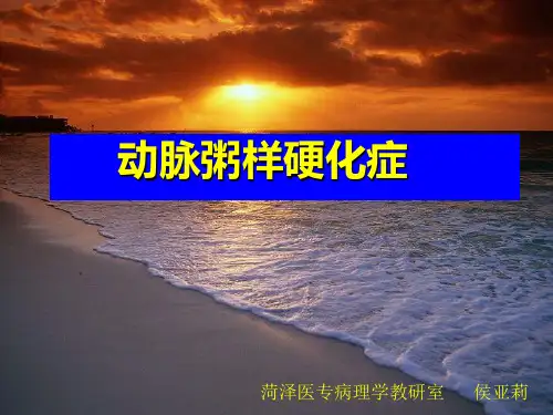 动脉粥样硬化