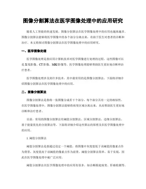 图像分割算法在医学图像处理中的应用研究