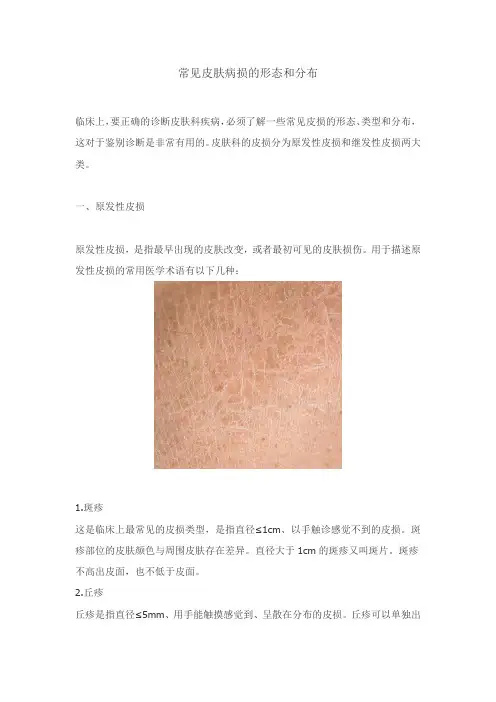常见皮肤病损的形态和分布
