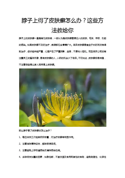 脖子上得了皮肤癣怎么办？这些方法教给你