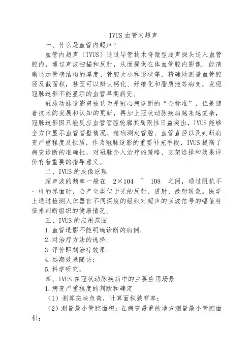 IVUS血管内超声