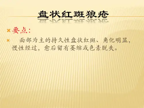 盘状红斑狼疮