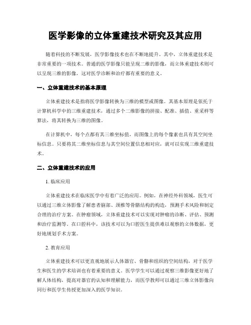 医学影像的立体重建技术研究及其应用