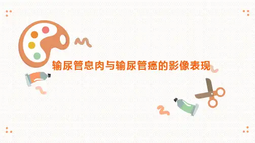 输尿管息肉和输尿管癌的影像表现