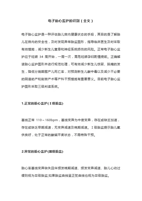 电子胎心监护的识别(全文)