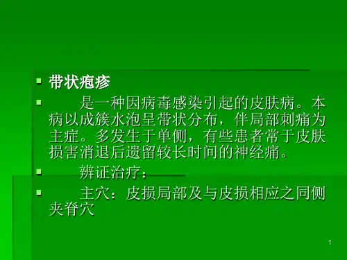 针灸学课件-带状疱疹
