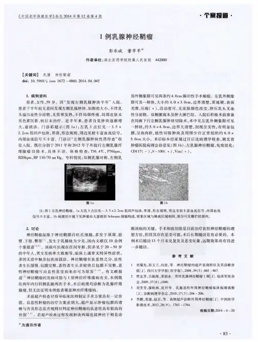 1例乳腺神经鞘瘤