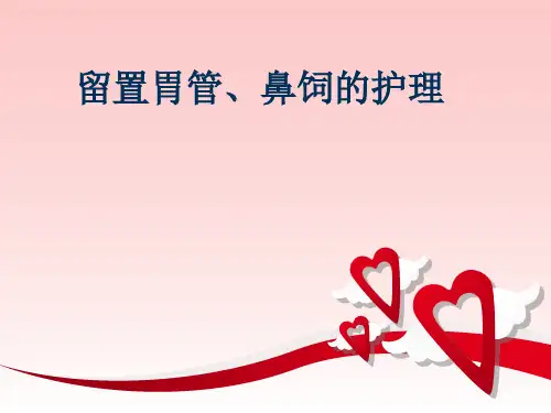 胃管留置ppt课件