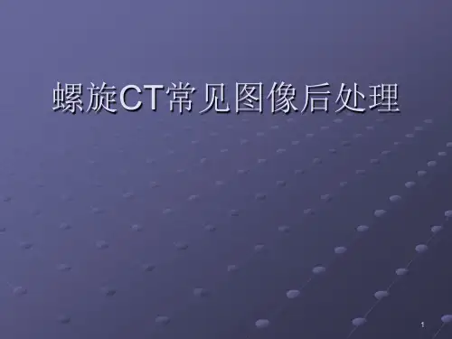 螺旋CT影像后处理PPT课件
