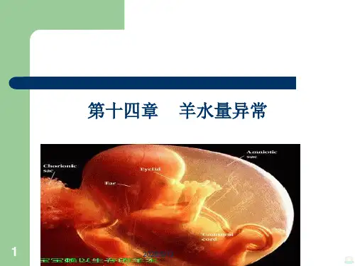 羊水异常讲PPT课件