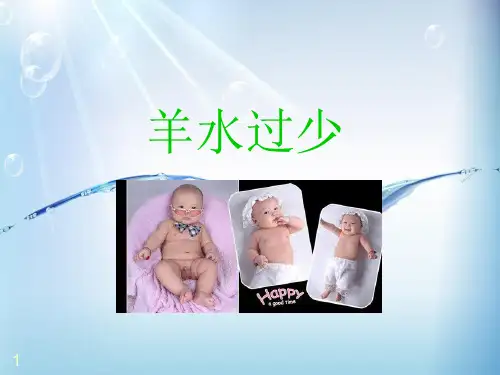 羊水过少ppt课件 (5)