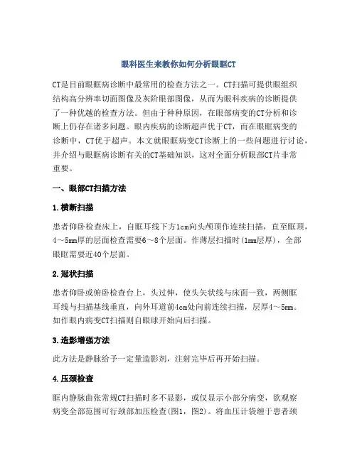 眼科医生来教你如何分析眼眶CT