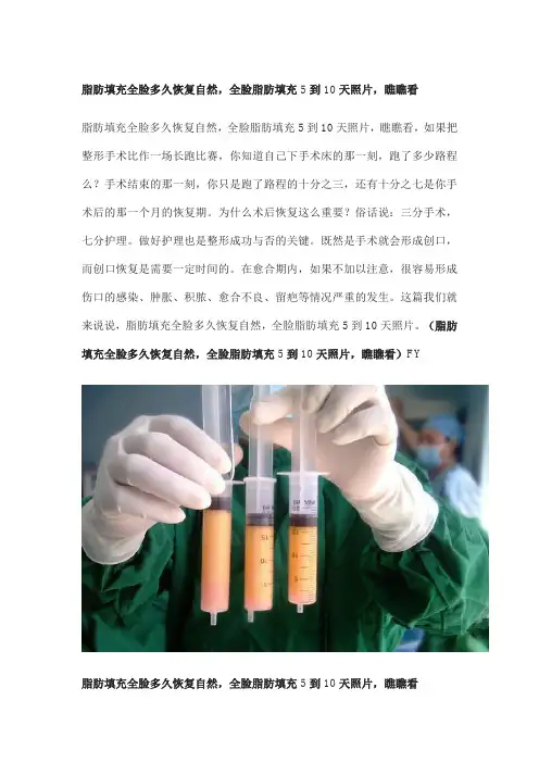 脂肪填充全脸多久恢复自然,全脸脂肪填充5到10天照片,瞧瞧看