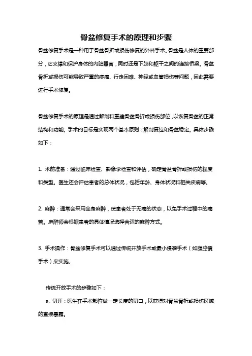 骨盆修复手术的原理和步骤