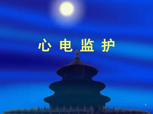 心电监护 (2)精选全文