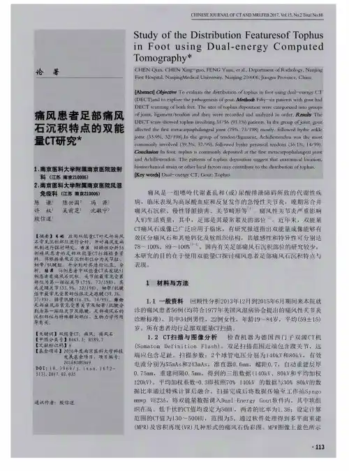 痛风患者足部痛风石沉积特点的双能量CT研究
