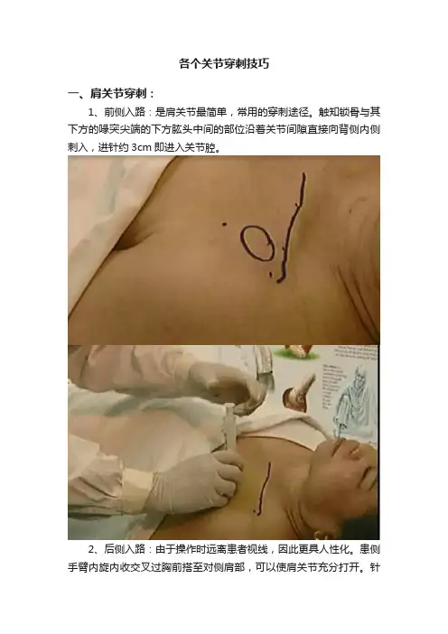 各个关节穿刺技巧
