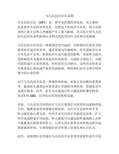 马凡氏综合征耳朵图