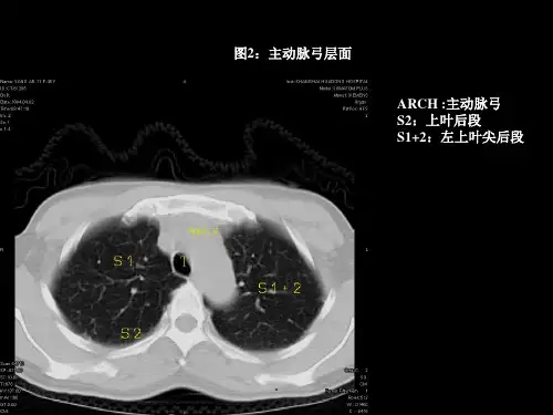 胸部CT的影像学表现PPT文档资料