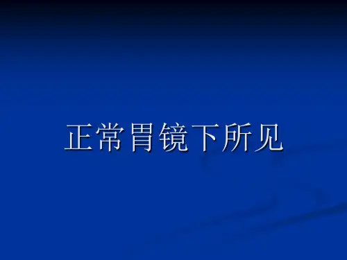 胃镜图谱