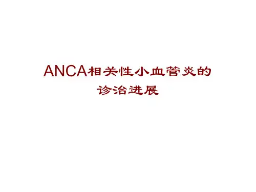 ANCA相关性小血管炎【21页】
