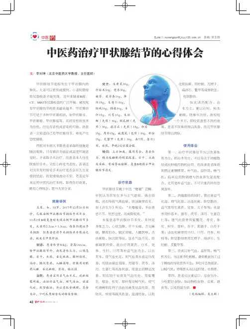 中医药治疗甲状腺结节的心得体会