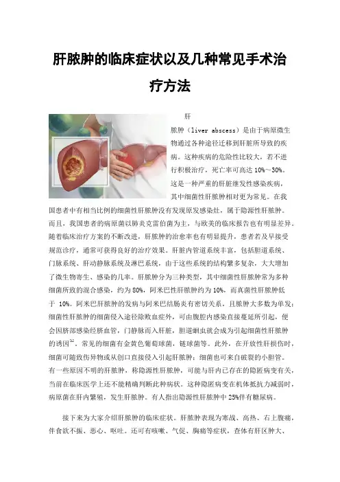 肝脓肿的临床症状以及几种常见手术治疗方法