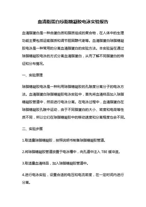 血清脂蛋白琼脂糖凝胶电泳实验报告