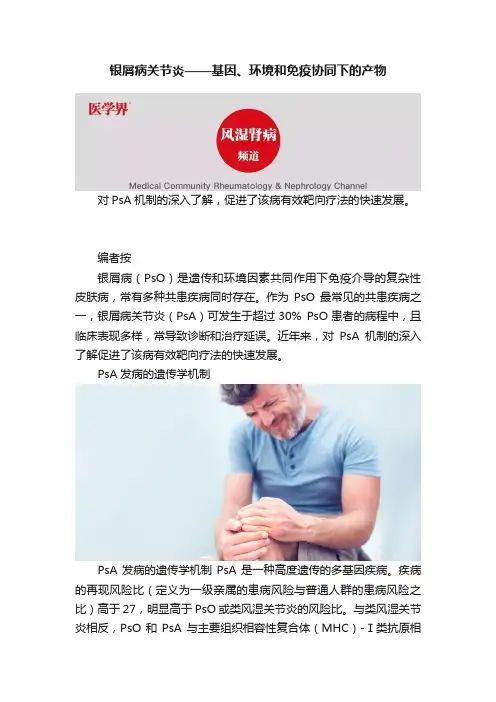 银屑病关节炎——基因、环境和免疫协同下的产物
