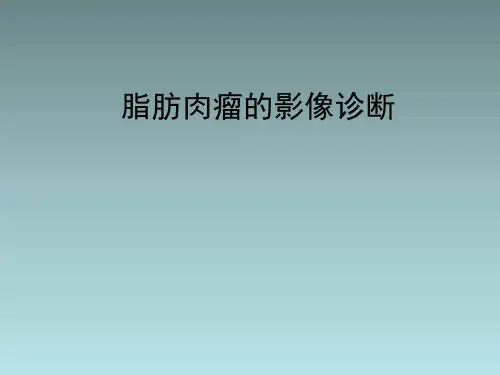 脂肪肉瘤的影像诊断