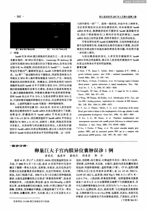 卵巢巨大子宫内膜异位囊肿误诊1例