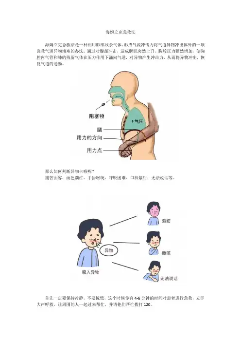 海姆立克急救法