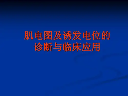 肌电图演示