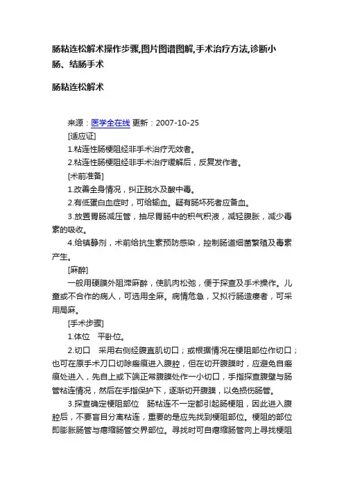 肠粘连松解术操作步骤,图片图谱图解,手术治疗方法,诊断小肠、结肠手术