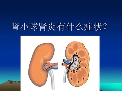 肾小球肾炎有什么症状？