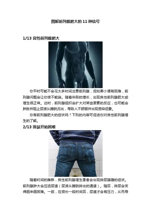 图解前列腺肥大的11种信号