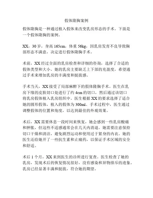 假体隆胸案例
