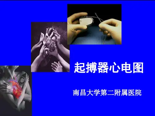 起搏器心电图48页PPT