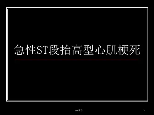急性ST段抬高型心肌梗死  ppt课件