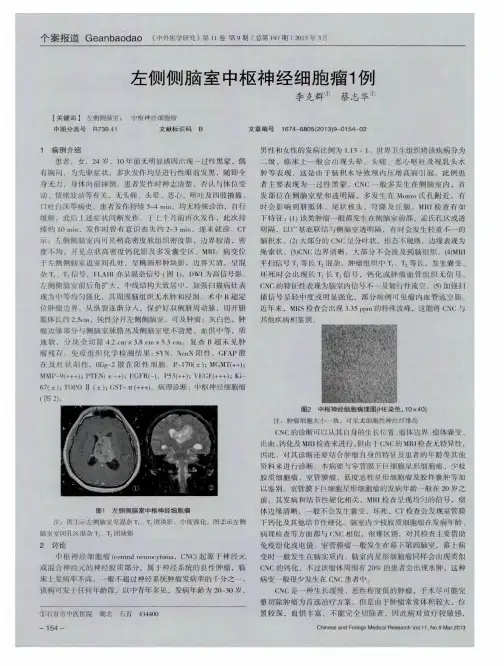 左侧侧脑室中枢神经细胞瘤1例