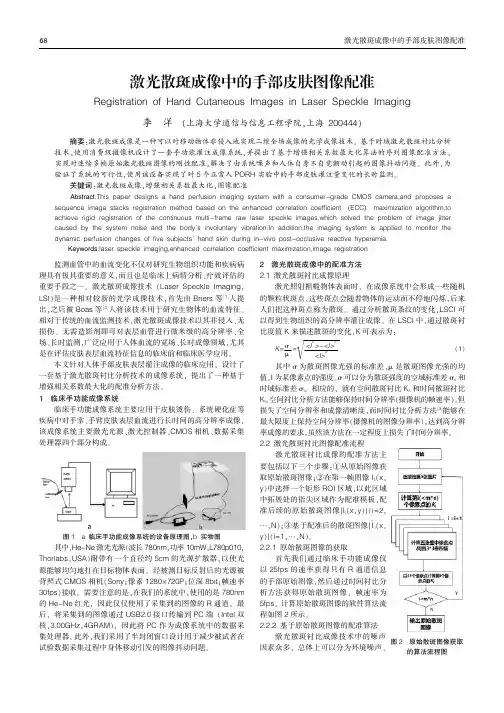 激光散斑成像中的手部皮肤图像配准